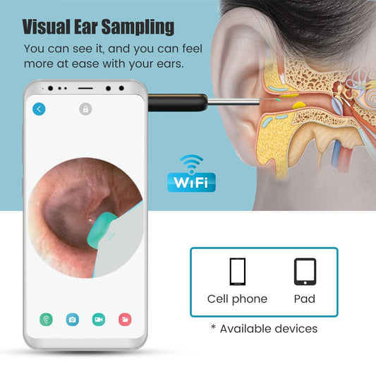 Wireless Visual Earpick / ওয়্যারলেস ভিজ্যুয়াল ইয়ারপিক!
